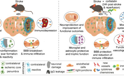 Cortistatina, una alternativa terapéutica frente al ictus: investigadores del CSIC destacan su eficacia en modelos preclínicos